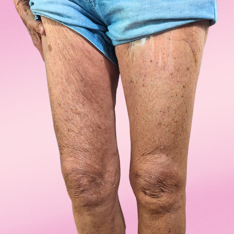 Bare Beauty Skin Strips