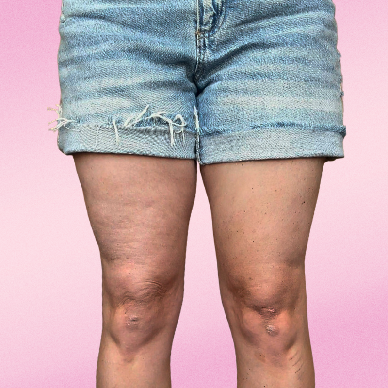 Bare Beauty Skin Strips